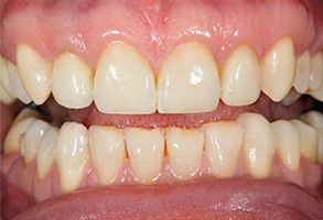 Randolph County dental images