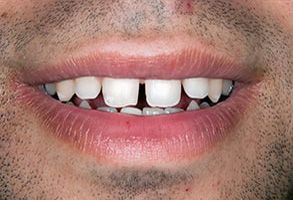 Asheboro dental images