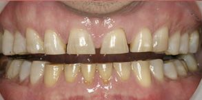 Asheboro dental images